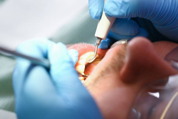 Best Broken Tooth Emergency  in Lynwood, IL