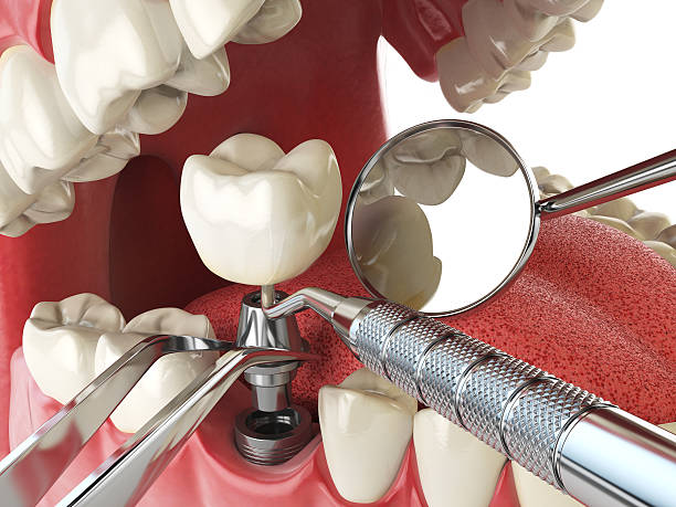 Best Root Canal Emergency Dentist  in Lynwood, IL